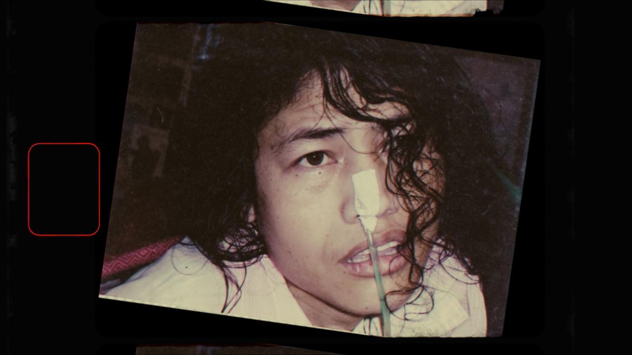 A close-up photo of a person with long, wet or disheveled hair. A medical feeding tube is inserted in their nose and secured with white tape. They are wearing a white shirt and looking slightly upward. The image is tilted and appears to be part of a filmstrip or slideshow.
